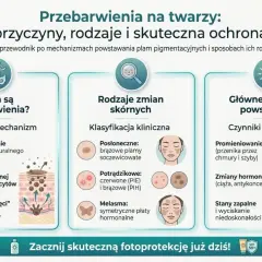 Przewodnik po przebarwieniach na twarzy: przyczyny, rodzaje zmian skórnych (posłoneczne, potrądzikowe, melasma) i skuteczne metody ochrony.