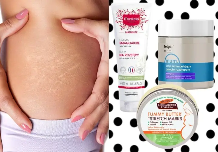 Skóra z widocznymi rozstępami, obok kosmetyki: krem Mustela, tołpa. mum. oraz Palmer's Tummy Butter – wszystko to maść na rozstępy.