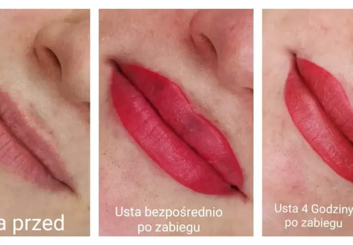 Trzy etapy gojenia ust po makijażu permanentnym: przed zabiegiem, bezpośrednio po i 4 godziny po. Widoczna zmiana koloru i opuchlizny.