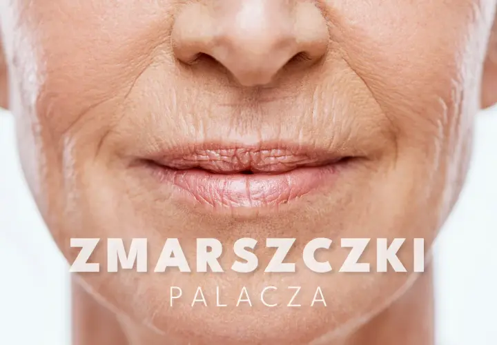 Zbliżenie na usta i nos kobiety, widoczne głębokie zmarszczki na policzkach, świadectwo przeżytych lat.