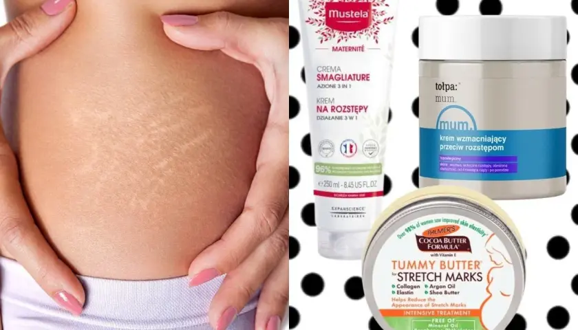 Skóra z widocznymi rozstępami, obok kosmetyki: krem Mustela, tołpa. mum. oraz Palmer's Tummy Butter – wszystko to maść na rozstępy.