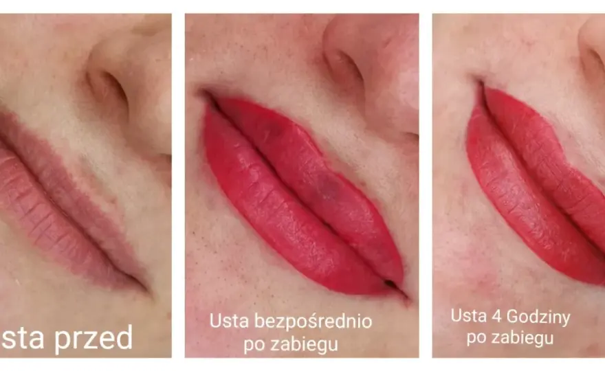 Gojenie ust po makijażu permanentnym - Co jest normą dzień po dniu?