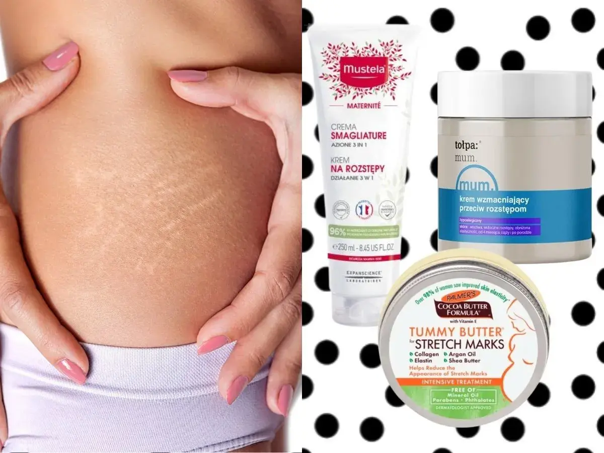 Skóra z widocznymi rozstępami, obok kosmetyki: krem Mustela, tołpa. mum. oraz Palmer's Tummy Butter – wszystko to maść na rozstępy.