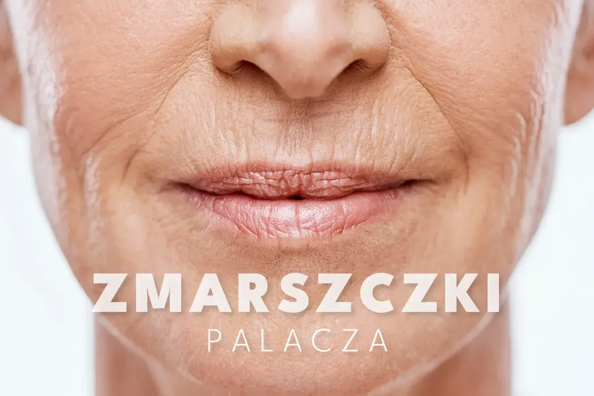 Zbliżenie na usta i nos kobiety, widoczne głębokie zmarszczki na policzkach, świadectwo przeżytych lat.