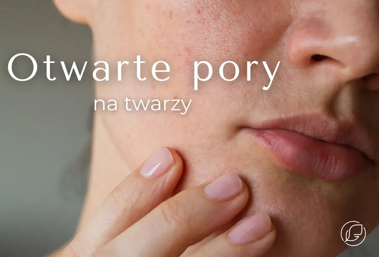 Zbliżenie na skórę twarzy z widocznymi rozszerzonymi porami. Dłoń delikatnie dotyka policzka, podkreślając teksturę skóry.