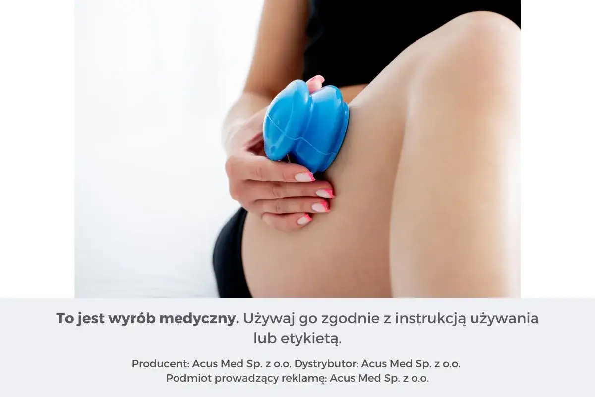 Dłoń z niebieską bańką chińską wykonuje masaż brzucha.